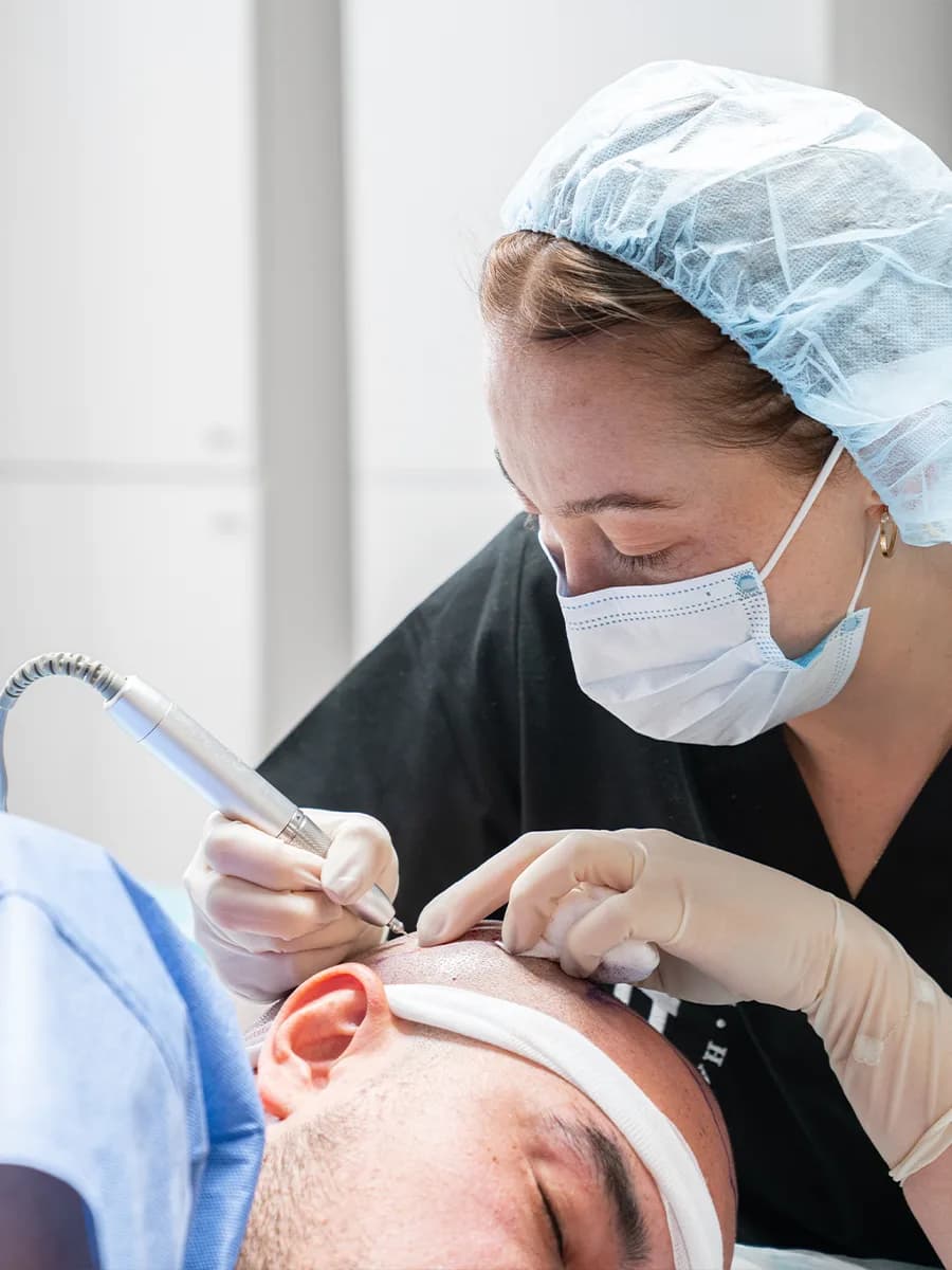 FUE Hårtransplantation modern teknik, naturligt resultat