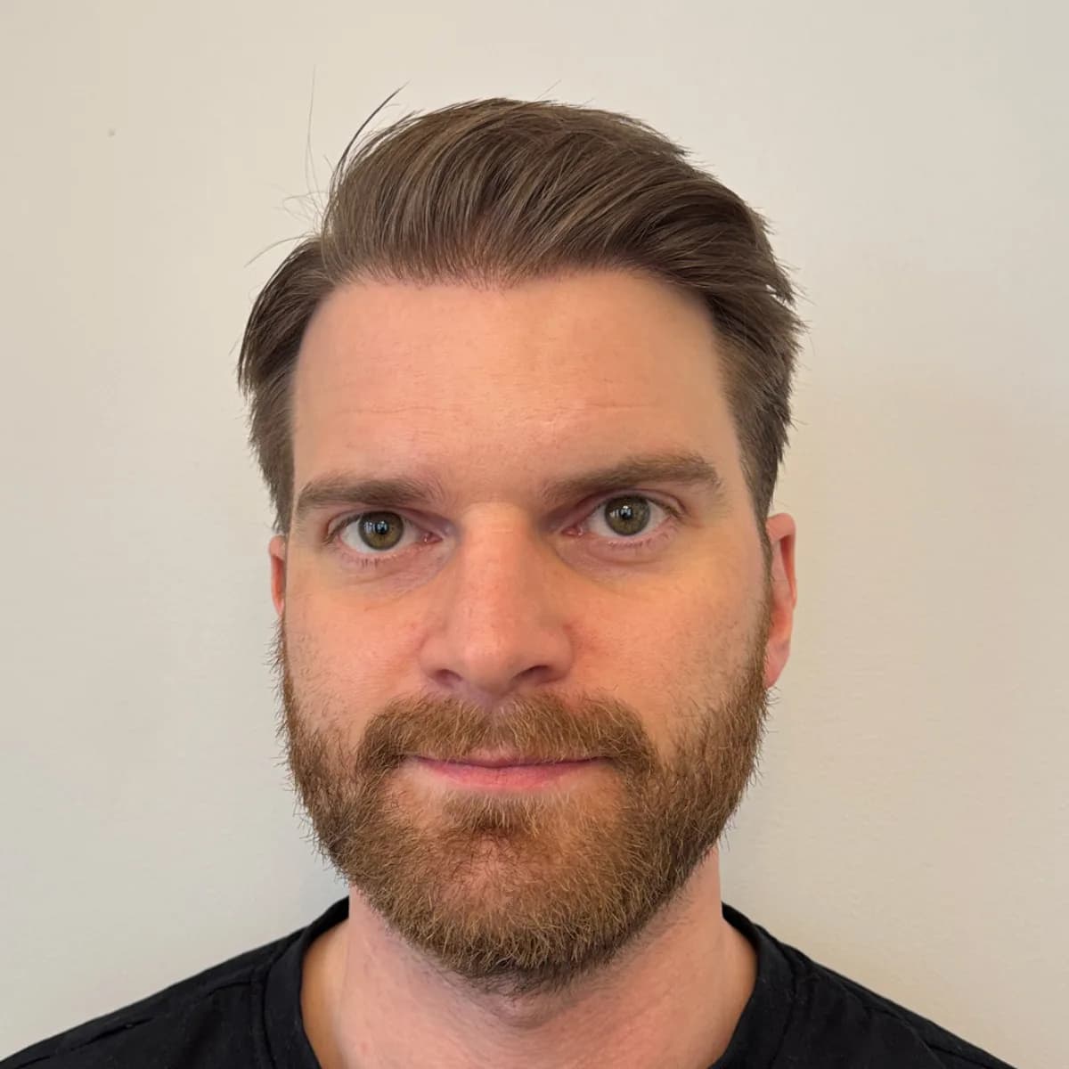 Lucas Simonsson – efter PRP-behandling