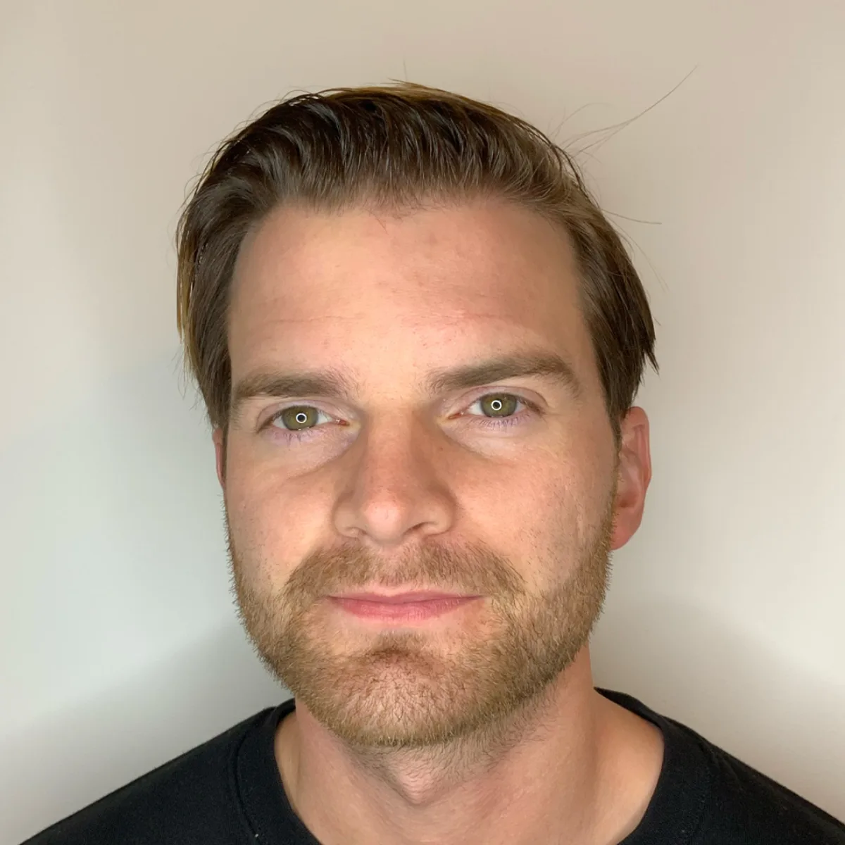 Lucas Simonsson – före PRP-behandling